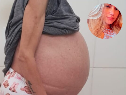 Sem diagnóstico e à espera de uma resposta: mulher de 34 anos luta há mais de um ano contra doença misteriosa
